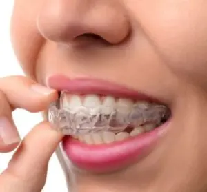 Invisalign Treatment Near You